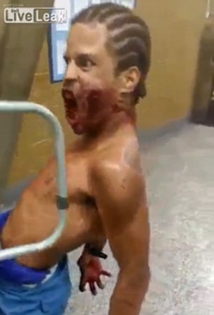 شاهد.. رجل ممسوس يثير رعب موظفي مستشفى