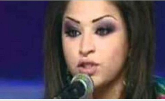صورة| لن تصدقوا من هي هذه النجمة العربية قبل عمليات التجميل