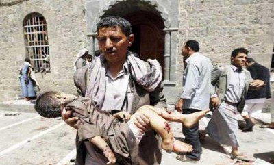 مقتل او اصابة ستة أطفال يومياً منذ بدء غارات التحالف في اليمن