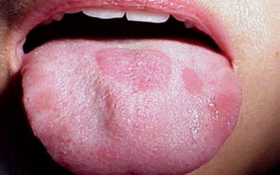 عراقية تقطع لسان زوجها بالسكين