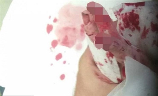 صور مؤلمة... هكذا أكلت الفئران ابنته حية!