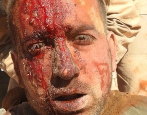 صور : قتلى وأسرى من حزب الله في هجوم لتنظيم ادولة شرق تدمر