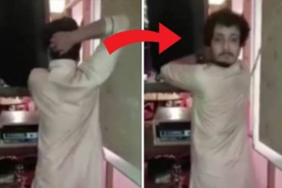 فيديو مذهل...شاب يدير رأسه 180 درجة فيديو مذهل...شاب يدير رأسه 180 درجة