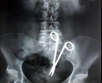 الاخطاء الطبية تقتل 80 مواطنا سنويا