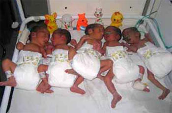 سيدة في المفرق تنجب 5 أطفال