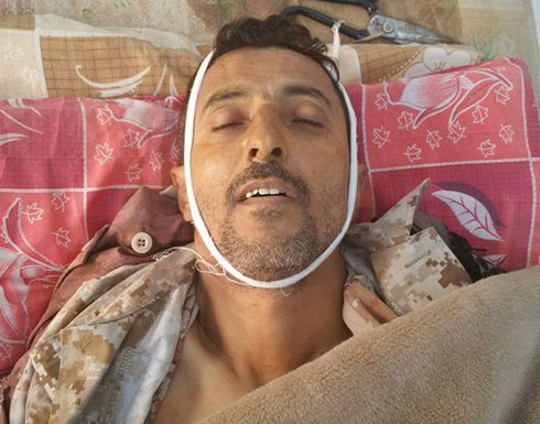 مقتل قائد في الجيش اليمني بهجوم للحوثيين في ثالث أيام الهدنة