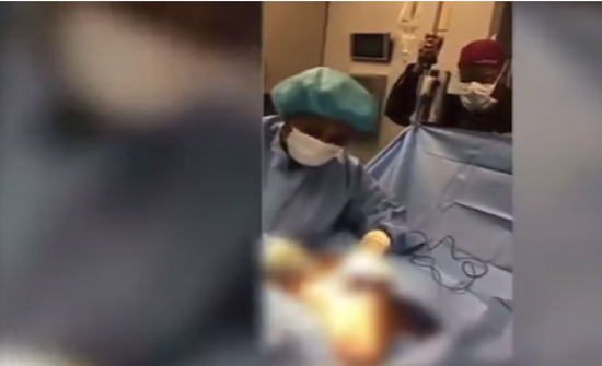 بالفيديو: طبيبة تجميل ترقص أثناء إجراء عملية جراحية