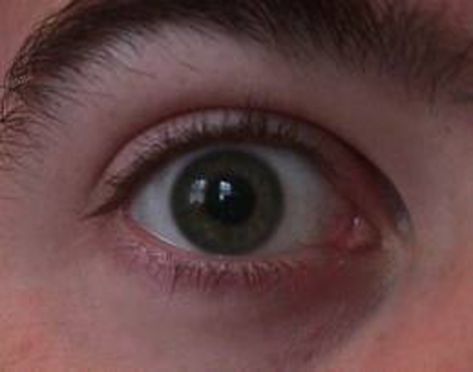 إطلاق حملة مكافحة فقدان البصر في السلط