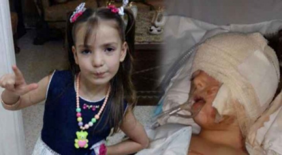 فقدت اذنها وكسور في جسمها  .... اصابة طفلة في حادث دهس باص روضتها بعمان