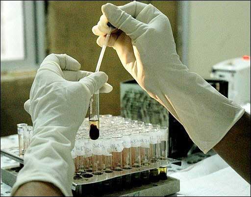 الجزائر .. فيروس غريب يفتك بالمرضى ويثير حيرة الاطباء !