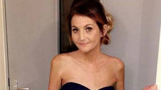 امرأة رقصت كل الليل بالكعب العالي... اضطرت إلى بتر قدمها