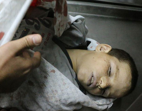 الصحة الفلسطينية: شهيد ومئات الجرحى بمواجهات مع الاحتلال بغزة والضفة الصحة الفلسطينية: شهيد ومئات الجرحى بمواجهات مع الاحتلال بغزة والضفة