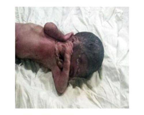 أم تشنق رضيعها وترميه فى “دوره مياه”