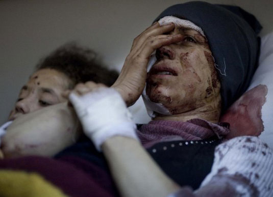 دخول 8 جرحى سوريين لمستشفى الرمثا