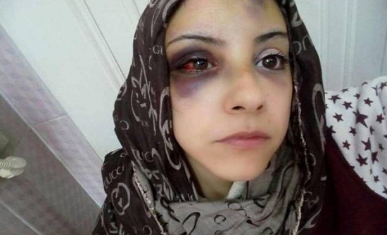 صور| جرّها في وسط الشارع وضربها بمساعدة والدته وإخوته.. والسبب! صور| جرّها في وسط الشارع وضربها بمساعدة والدته وإخوته.. والسبب!