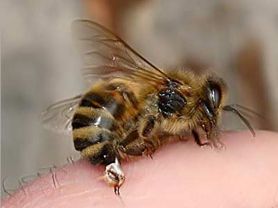 لسعة نحلة تدخل اربعينيا للعناية المركزة 