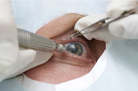 مستشفى معاذ بن جبل يتسلم اجهزة جراحة ومعدات لجراحة العيون