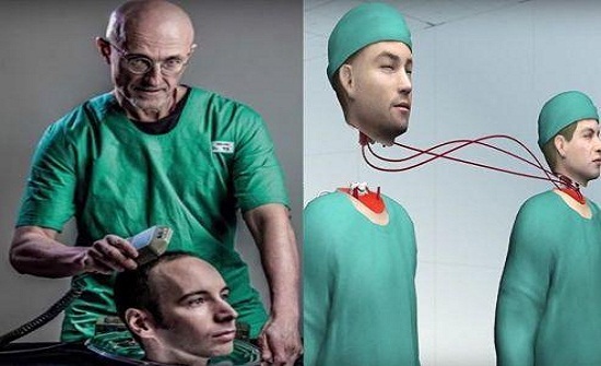 أول عملية زراعة رأس تجري لمتبرع صيني أول عملية زراعة رأس تجري لمتبرع صيني