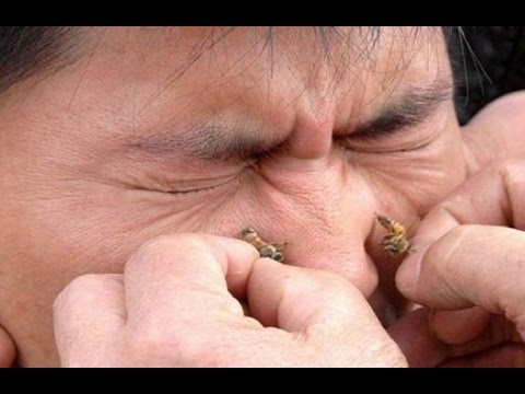 الكشف عن علاج نبوي فعال للتخلص من التهاب الجيوب الأنفية