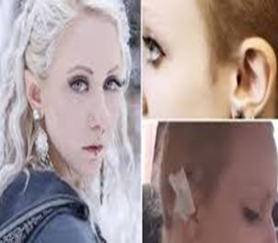 تقص جزءاً من أذنيها لتشبه جنيّة في فيلم خيالي