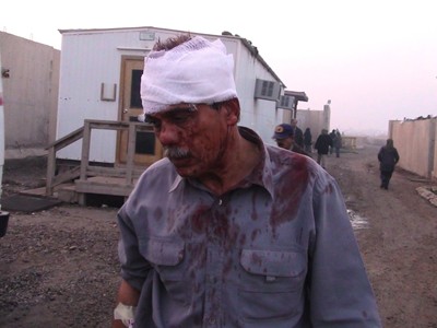 المقاومة الايرانية تناشد نقل جرحى ليبرتي الى أوروبا