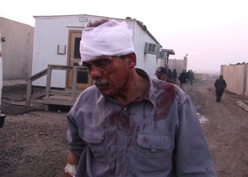 قوات المالكي تمنع مرضى مخيم ليبرتي من تلقي العلاج