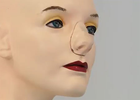 الدمية المريضة