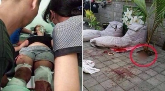 زوجٌ غيور يبتر قدمي زوجته أمام أولادها!