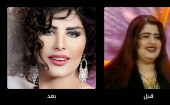 صور- حساب على انستغرام يفضح عمليات تجميل النجمات! صور- حساب على انستغرام يفضح عمليات تجميل النجمات!
