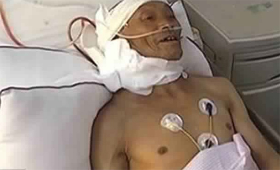 بالصور: ورم يزن 33 كيلوغراماً في رقبة مسن.. ! بالصور: ورم يزن 33 كيلوغراماً في رقبة مسن.. !