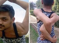 شاهد: شاب يستطيع ثني أكتافه 360 درجة