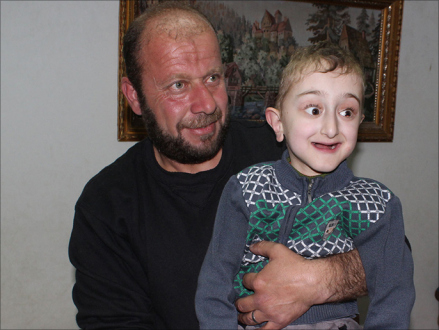 عكرمة.. طفل فلسطيني من "زجاج"