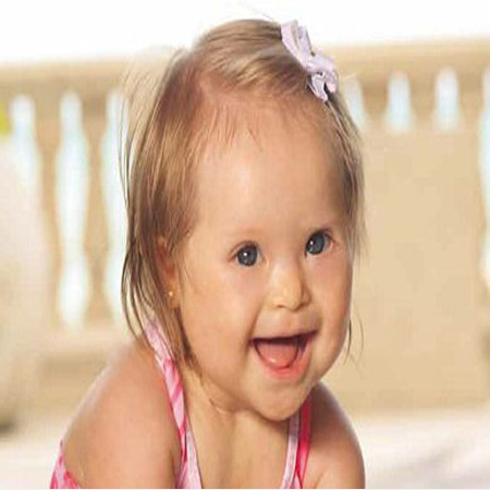 7 الاف مصاب بمتلازمة داون في المملكة يتلقون العلاج المجاني