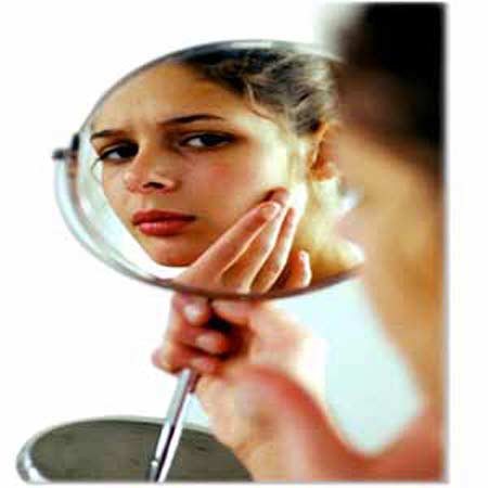 علاجات منزلية تمنع ظهور حب الشباب علاجات منزلية تمنع ظهور حب الشباب
