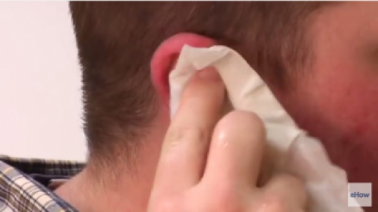 مزج الخل مع السبيرتو وضع بضع قطرات من هذا المزيج في أذنه مدة 60 ثانية. النتائج مذهلة..