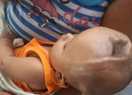 تخلى عنه والداه بعد ولادته.. وكيف تصف الجدة معاناة حفيدها؟ تخلى عنه والداه بعد ولادته.. وكيف تصف الجدة معاناة حفيدها؟