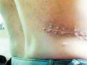 مدعي عام غرب عمان يقرر توقيف 3 اردنيين بجرم المتاجرة بالاعضاء البشرية