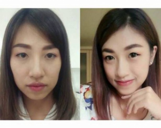 بالصورة - طريقة غريبة لتصغير الشفاه الضخمة... هكذا تصبحين أكثر أنوثة! بالصورة - طريقة غريبة لتصغير الشفاه الضخمة... هكذا تصبحين أكثر أنوثة!