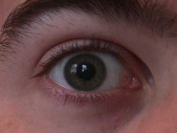 ذوو المتوفي محمد بحادث سير يتبرعون بقرنيتيه