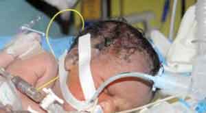 وفاة طفلة رضيعة بعد ان دخلت في غيبوبة 5 أشهر