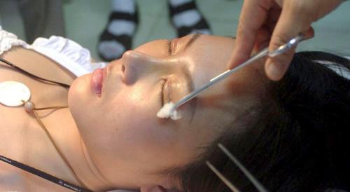 عملية تجميل لسبب عجيب