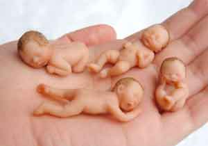 سيدة تضع 4 توائم ذكور في عملية نادرة من نوعها