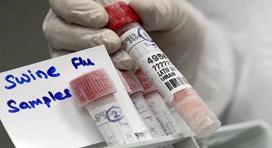 التقرير الطبي : الطالبة آلاء توفيت بسبب التهاب الحلق وليس إنفلونزا الخنازير التقرير الطبي : الطالبة آلاء توفيت بسبب التهاب الحلق وليس إنفلونزا الخنازير