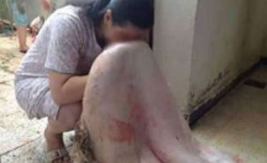 بالفيديو.. لماذا يمسح المضحون وجهوههم في جلد الأضحية ؟