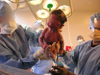 مصارعة بين طبيبين داخل غرفة الولادة