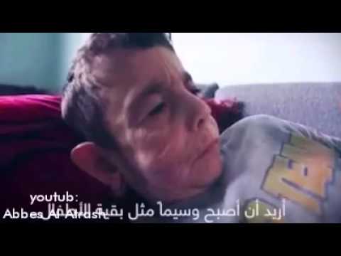 طفل في جسد رجل عجوز… قصة من قصص الشيخوخة المبكرة “فيديو”