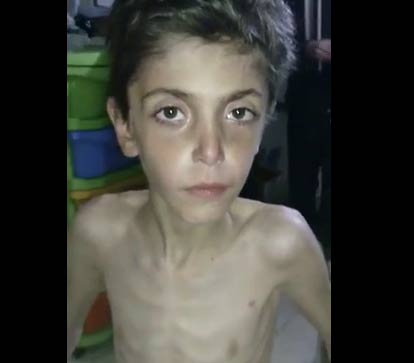 فيديو : طفل سوري لم يأكل اي شئ