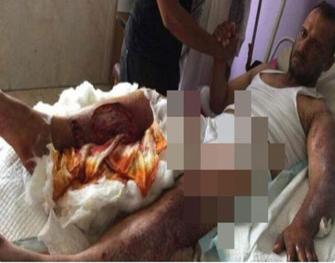 بيجي: إصابة قائد الميليشيا التي أحرقت الشاب السني حياً بجروح خطيرة بيجي: إصابة قائد الميليشيا التي أحرقت الشاب السني حياً بجروح خطيرة