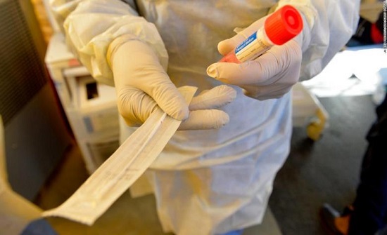 صحة المفرق: نتائج سلبية لـ655 عينة عشوائية في المحافظة