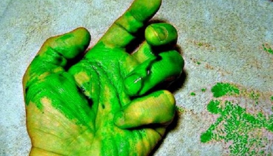 فيديو| متى يتحول دمّك إلى اللون الأخضر؟